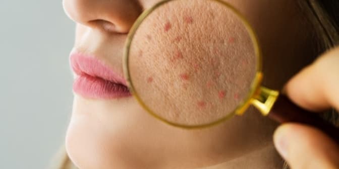 Dermatolog online - najczęstsze pytania dotyczące konsultacji